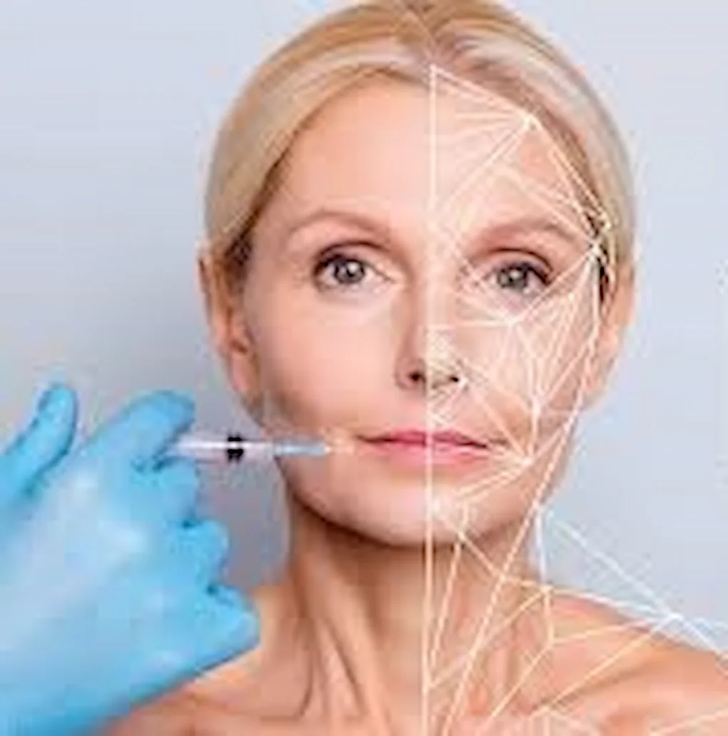 Aplicación de Ellansé para rejuvenecimiento facial y estimulación de colágeno en clínica estética
