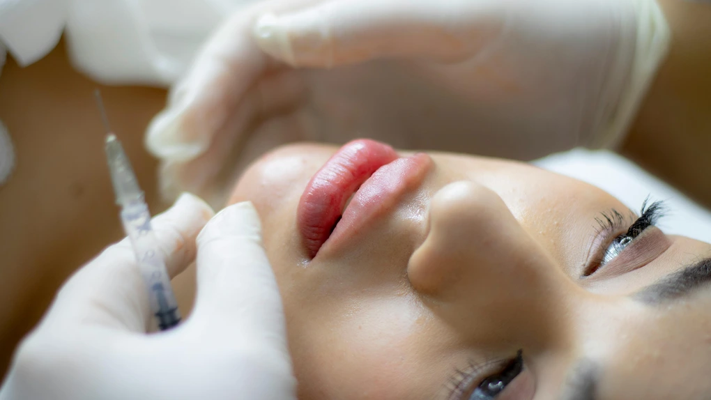 relleno de labios